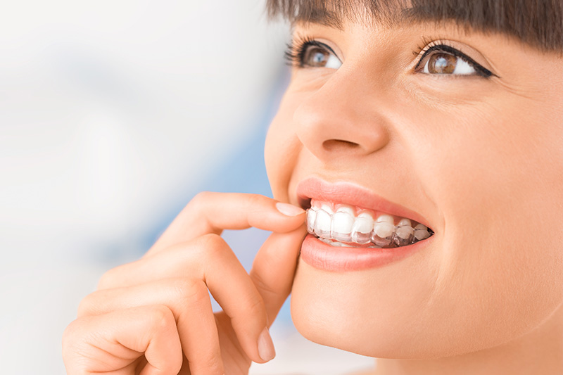 Invisalign in Greenville